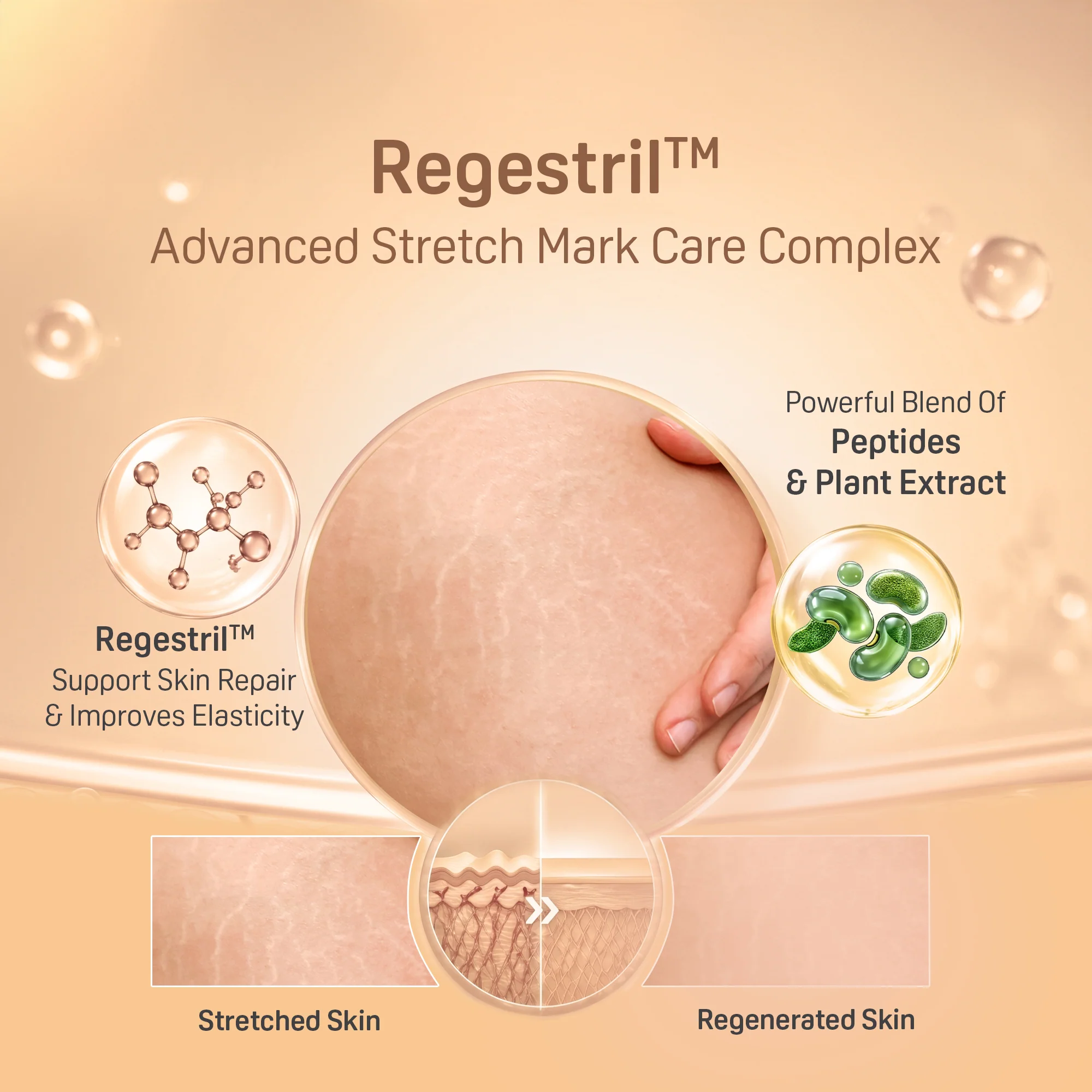 STRETCH MARKS CREAM 45GM - Image 5