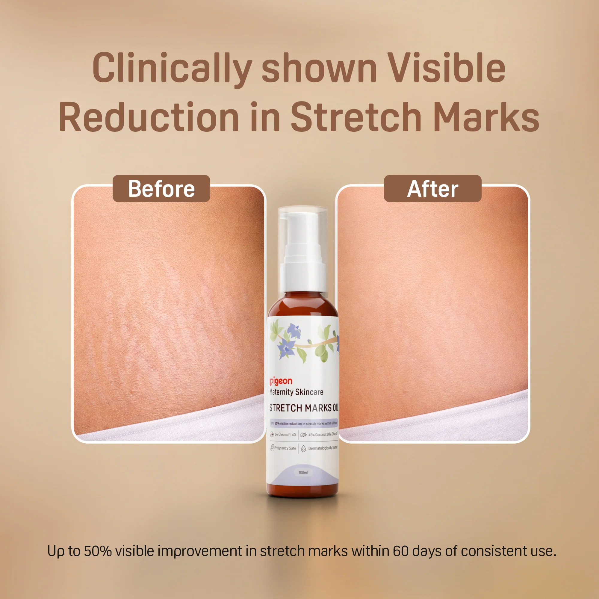 STRETCH MARKS OIL 100 ML - Image 8